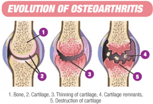 Image from https://www.alterni.com/Wellness/costliest-disease-ever-known-b24.html 