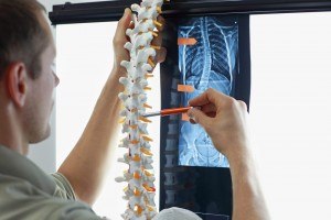 Scoliosis and Chiropractic 