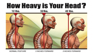 How To Fix Forward Head Posture