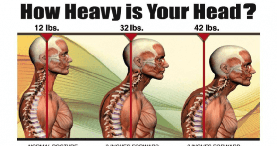How To Fix Forward Head Posture