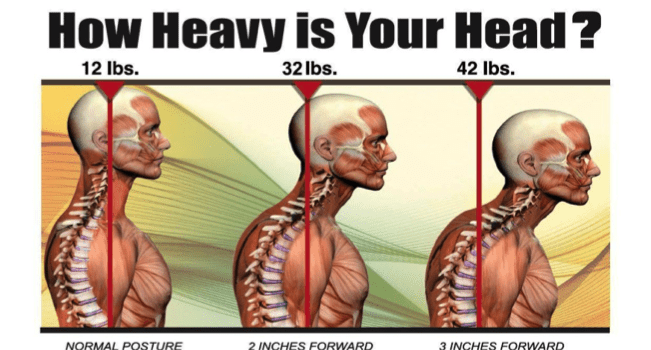 How To Fix Forward Head Posture