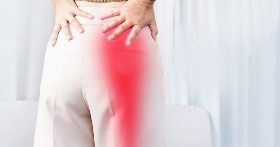 How To Help Sciatica at Home